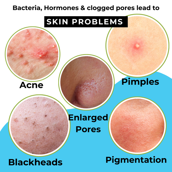 SPOT ERASER | Blemish Control Serum